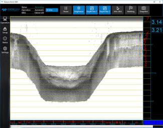 Odom ECHOTRAC E20 by Teledyne